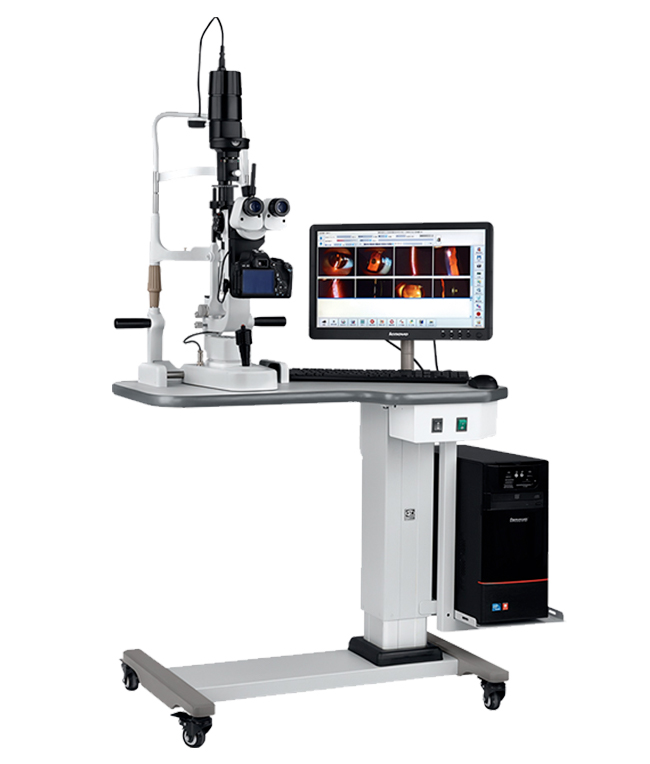 数码裂隙灯显微镜